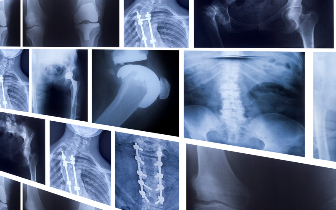 Titanium—The Backbone of Modern Industry: How Supra Alloys Powers Progress Across Sectors